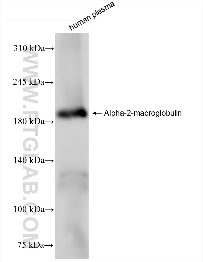 WB analysis of human plasma using 84347-5-RR (same clone as 84347-5-PBS)