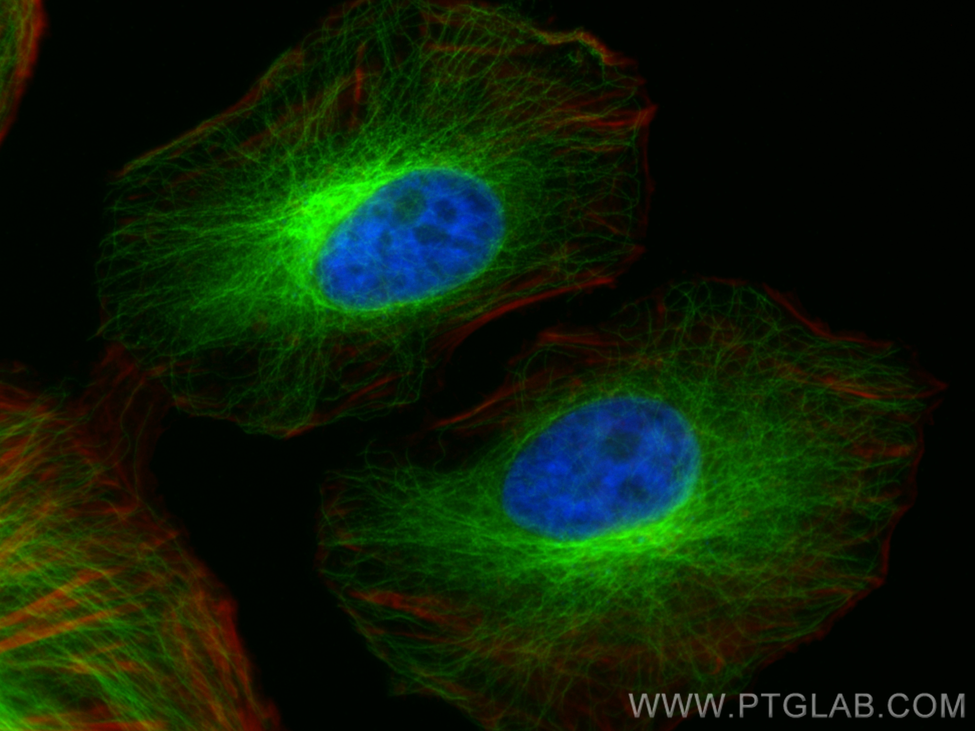 IF Staining of HeLa using 80762-1-RR