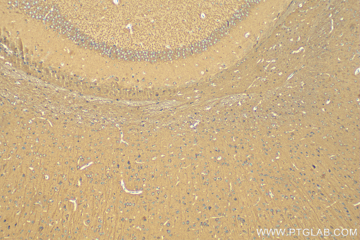 IHC staining of mouse brain using 80762-1-RR (same clone as 80762-1-PBS)