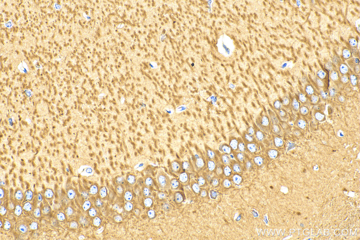 IHC staining of mouse brain using 80762-1-RR