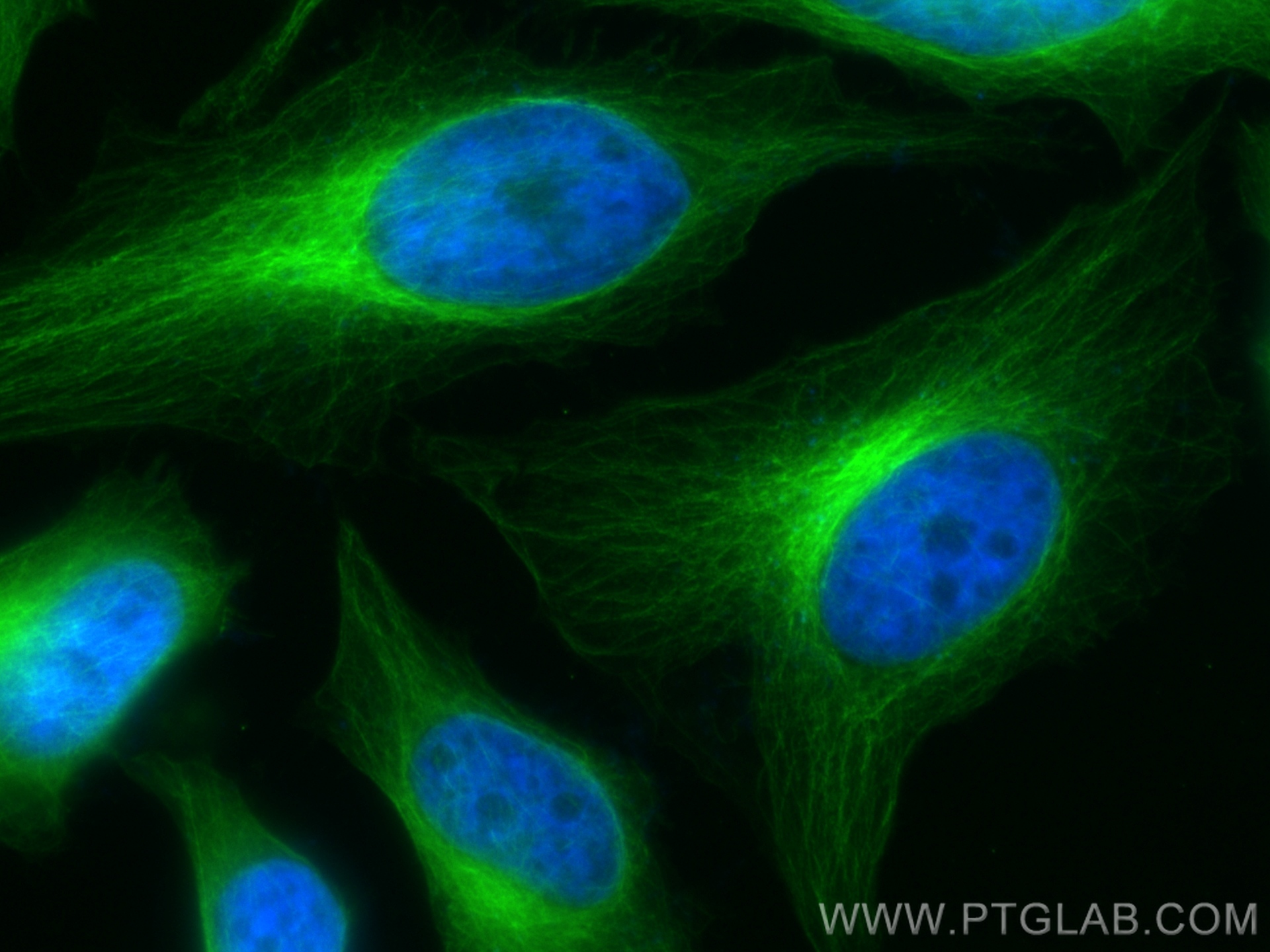 IF Staining of HeLa using CL488-80762