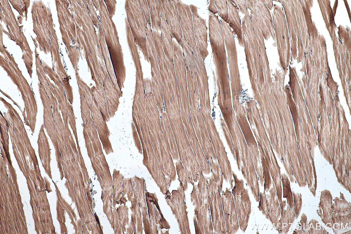 IHC staining of mouse skeletal muscle using 67078-1-Ig (same clone as 67078-1-PBS)