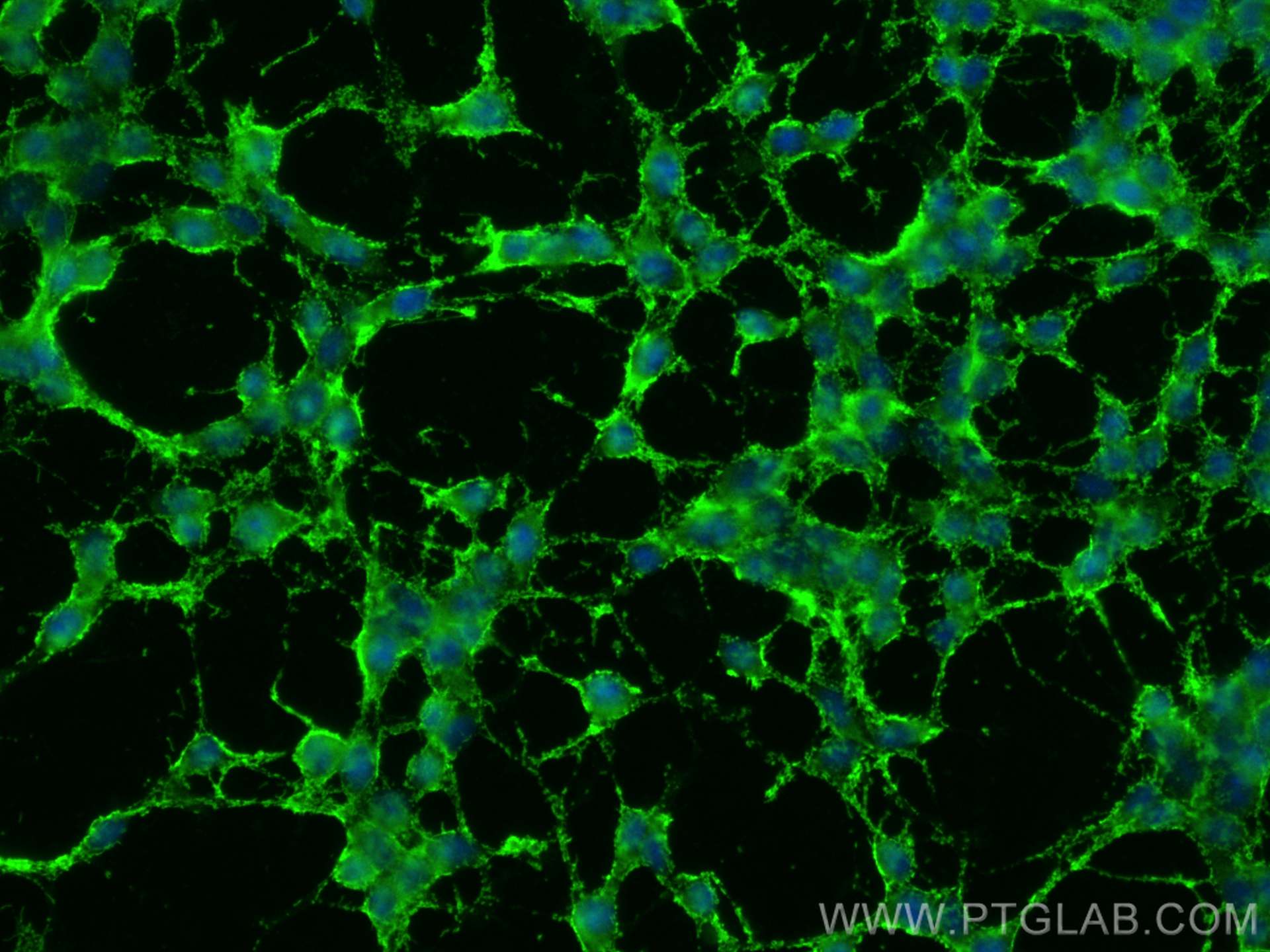 IF Staining of SH-SY5Y using 25524-1-AP