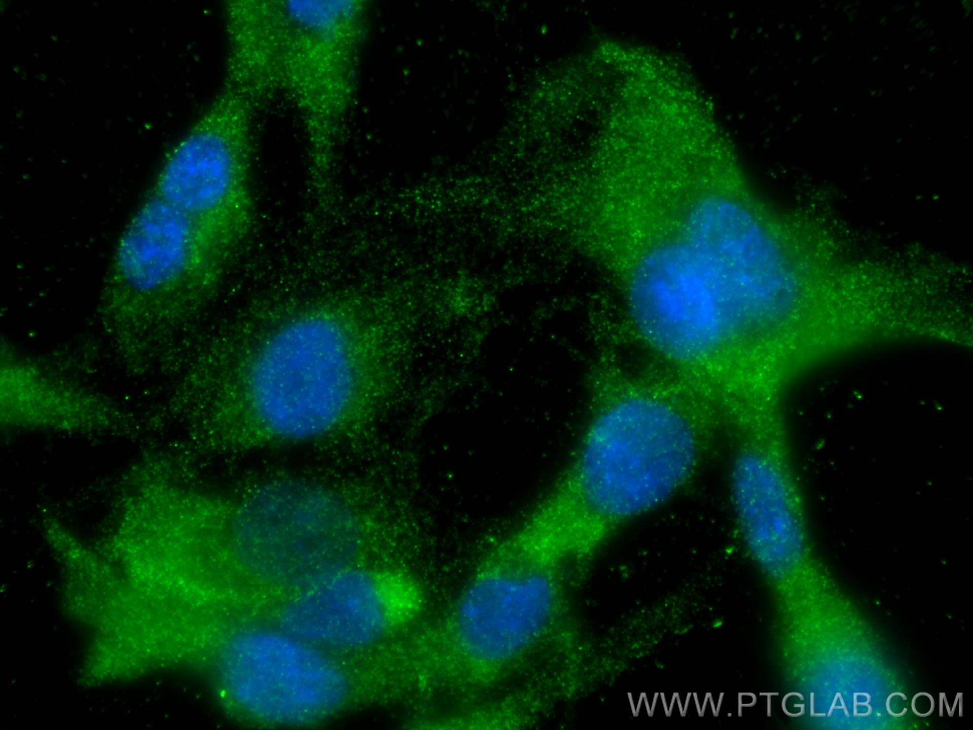 IF Staining of HUVEC using 68618-1-Ig (same clone as 68618-1-PBS)