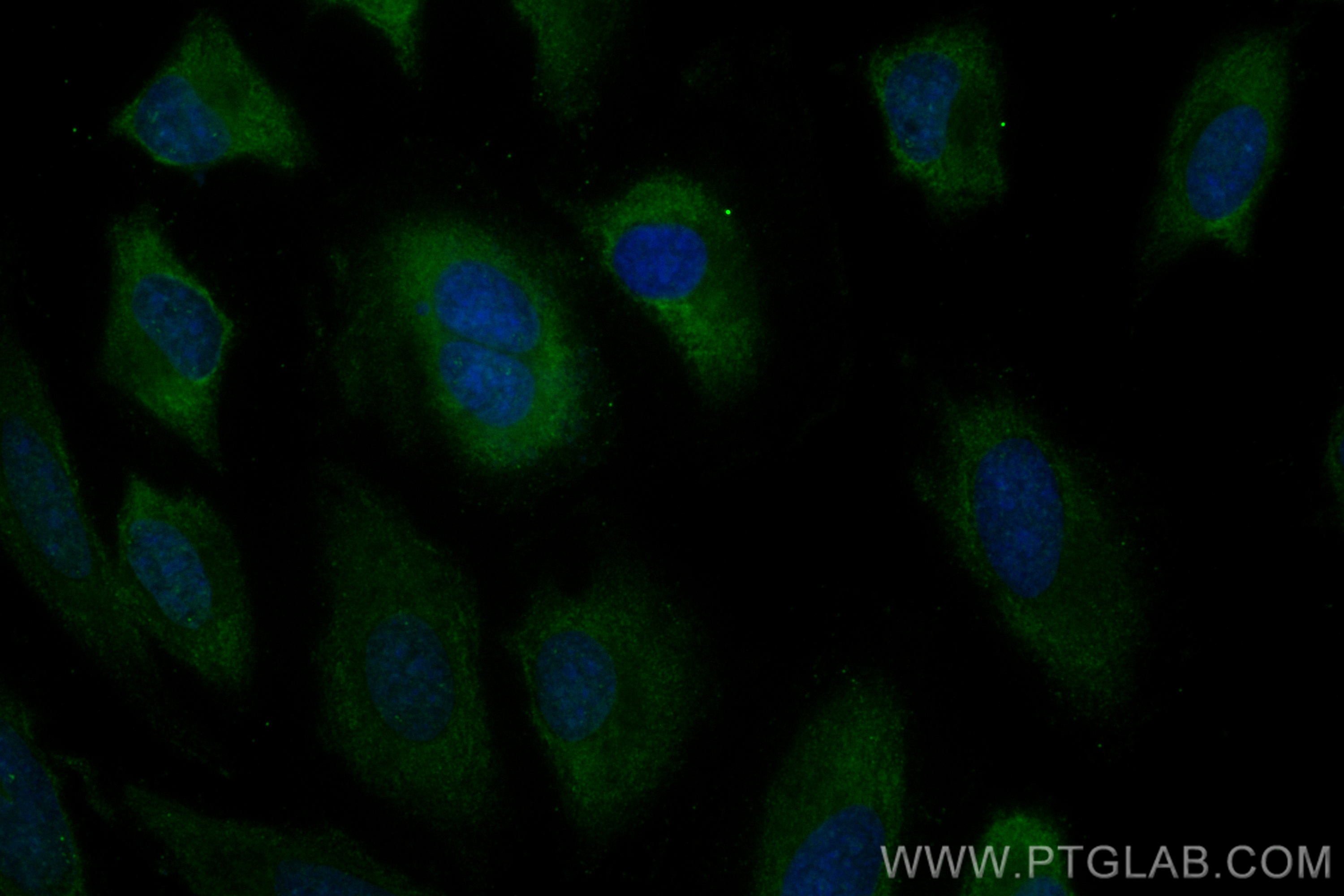 IF Staining of HeLa using CL488-68618