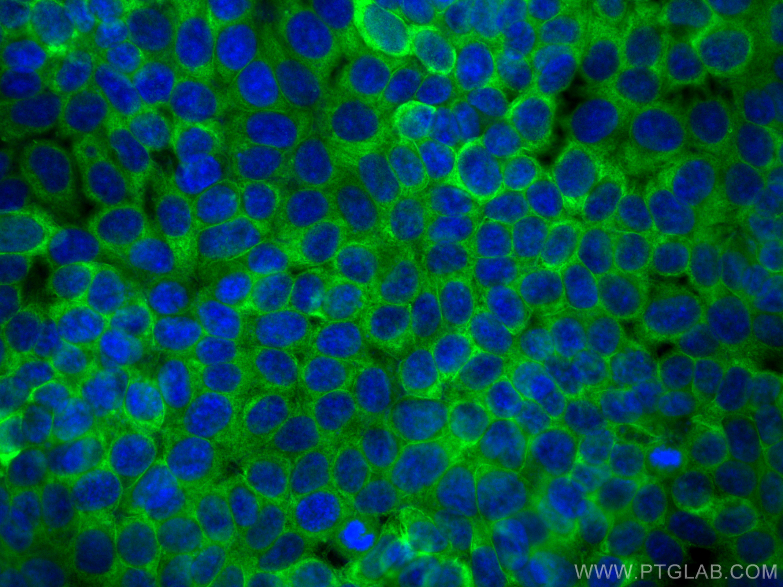 IF Staining of MCF-7 using CL488-60051