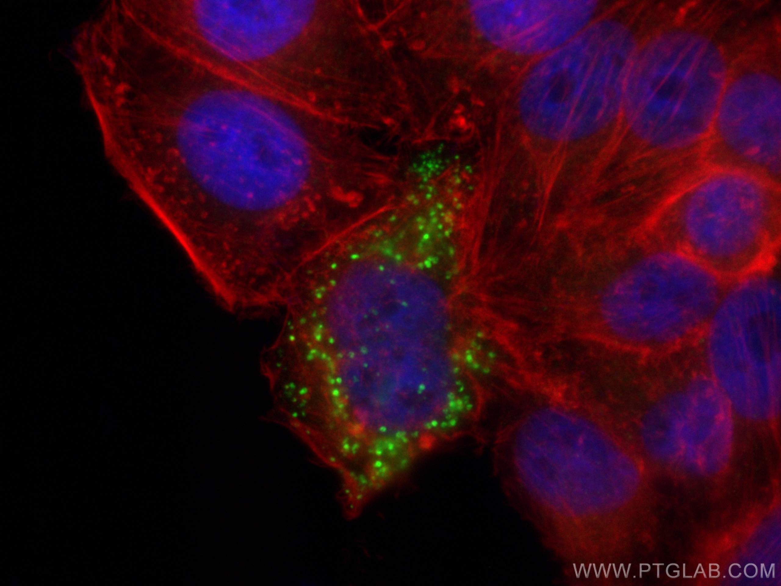 IF Staining of HepG2 using 31454-1-AP