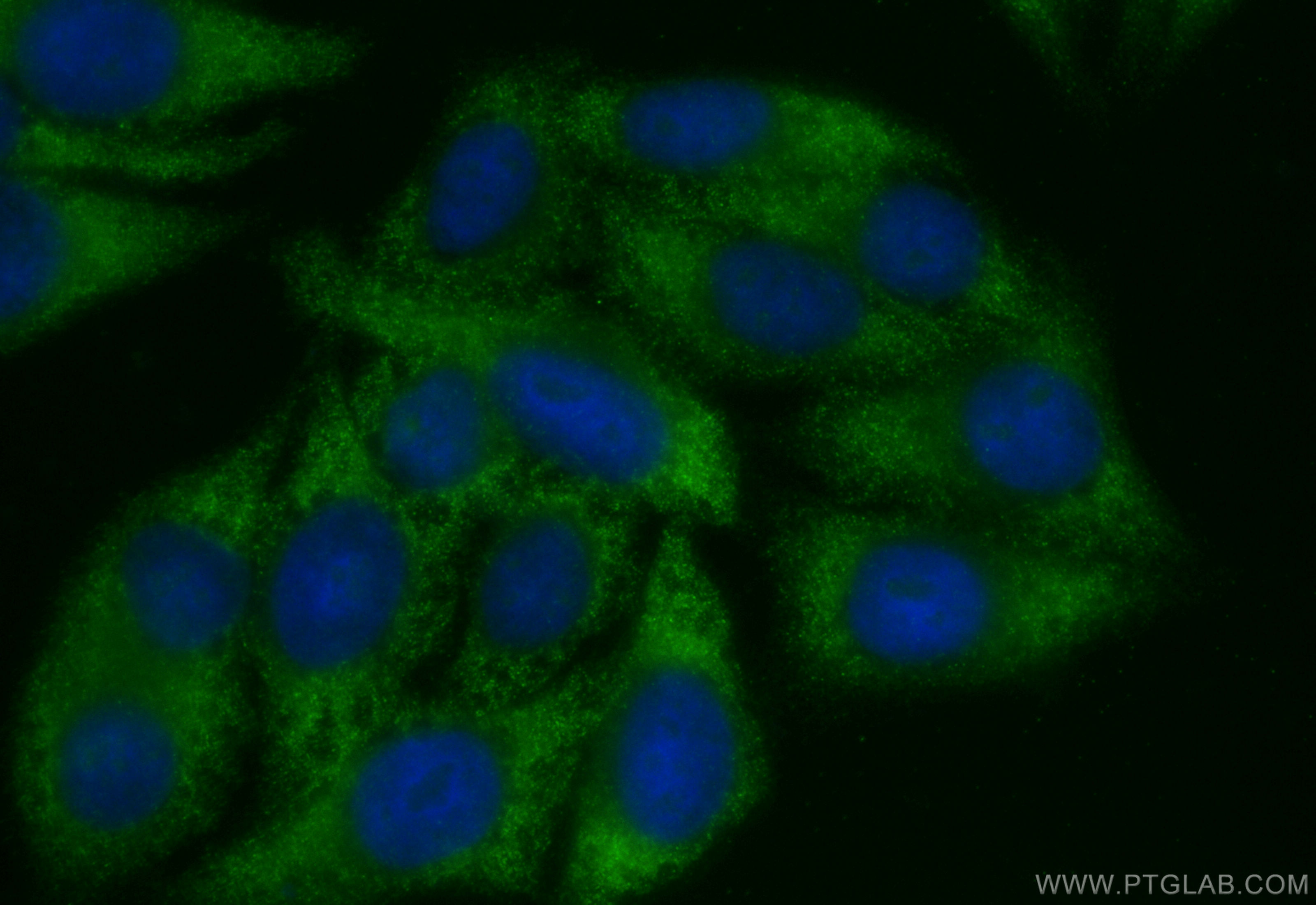 IF Staining of HepG2 using 82975-1-RR (same clone as 82975-1-PBS)