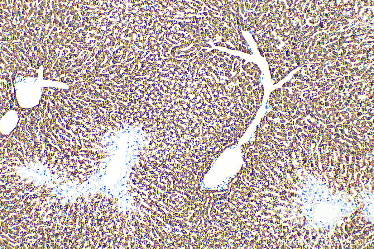 IHC staining of mouse liver using 82975-1-RR (same clone as 82975-1-PBS)
