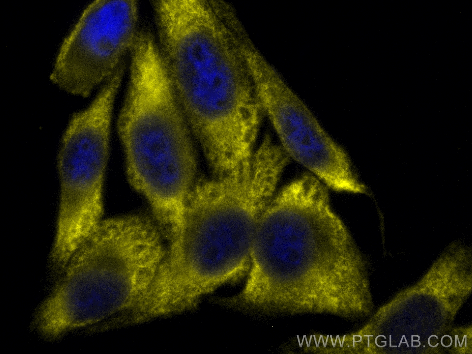 Arginase-1