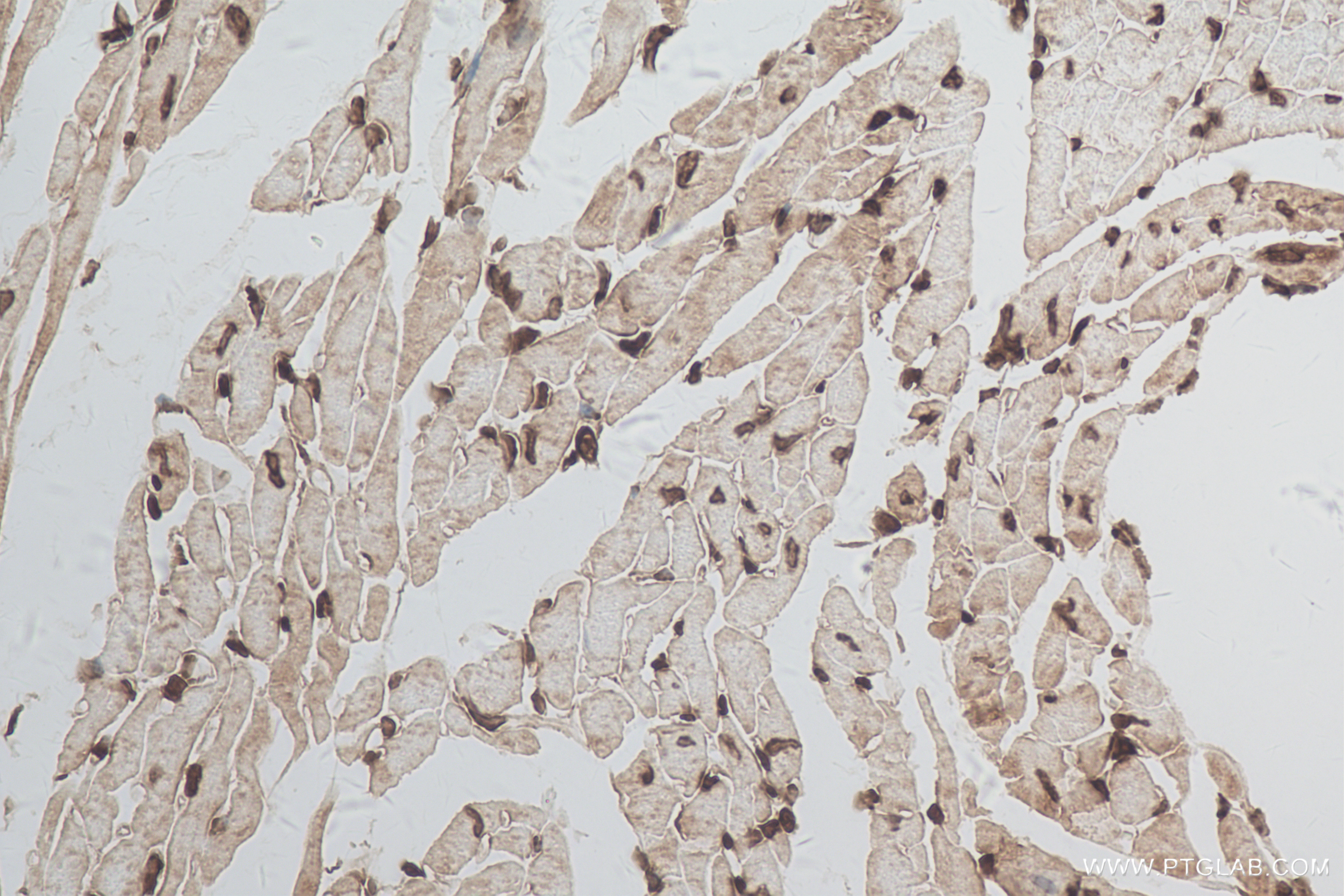 IHC staining of mouse heart using 84305-1-RR (same clone as 84305-1-PBS)