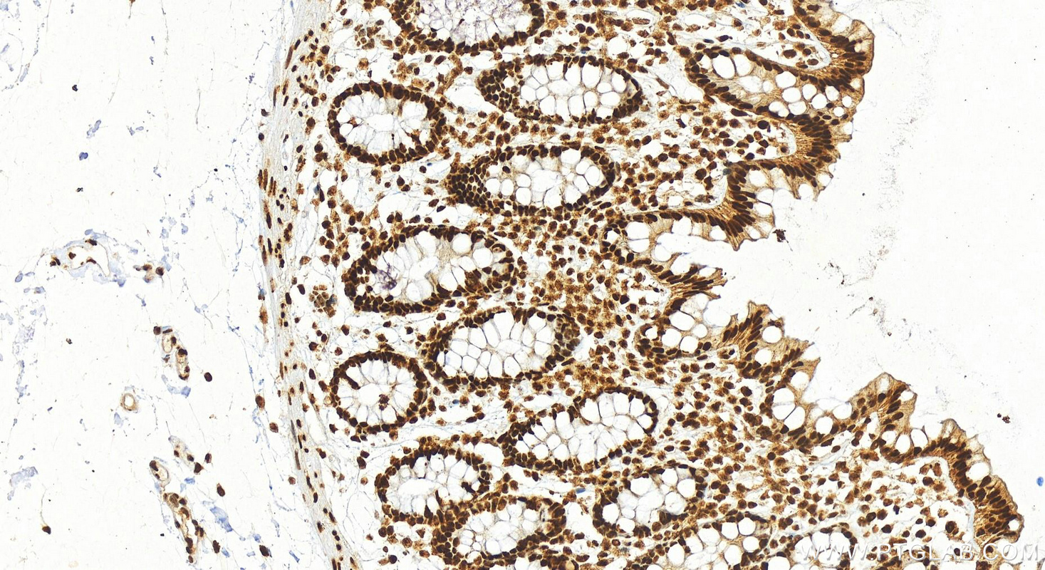 IHC staining of human normal colon using 82030-1-RR (same clone as 82030-1-PBS)