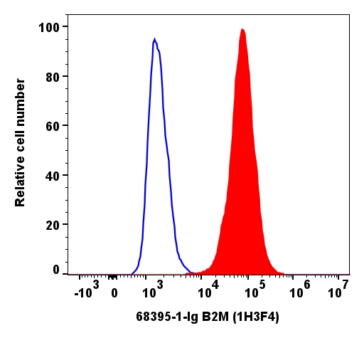 Beta-2-Microglobulin