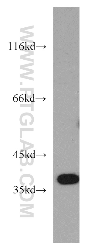 WB analysis of mouse brain using 55049-1-AP