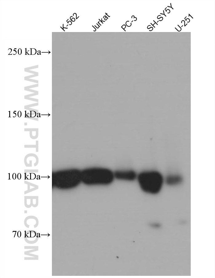 WB analysis using 66711-1-Ig