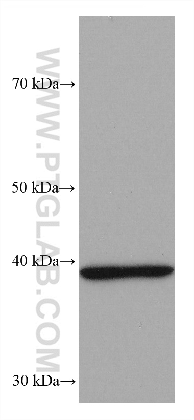 WB analysis of mouse brain using 66711-1-Ig (same clone as 66711-1-PBS)