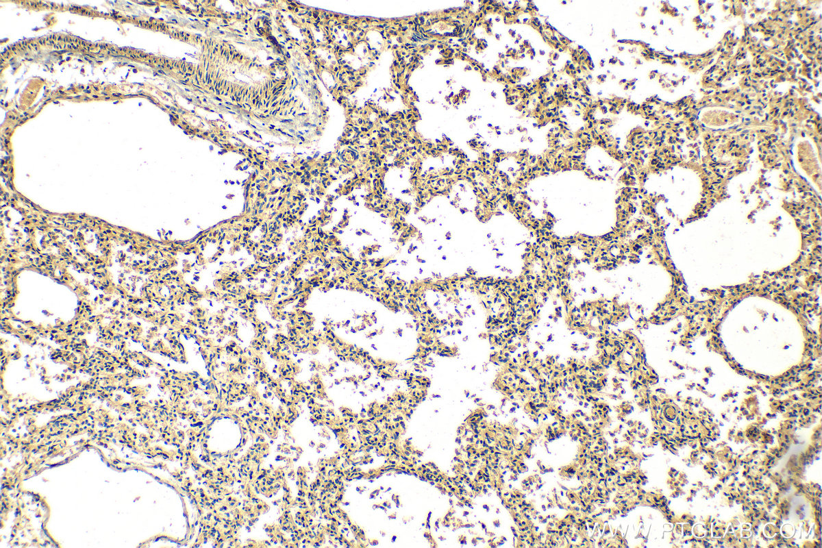 IHC staining of human lung using 20422-1-AP