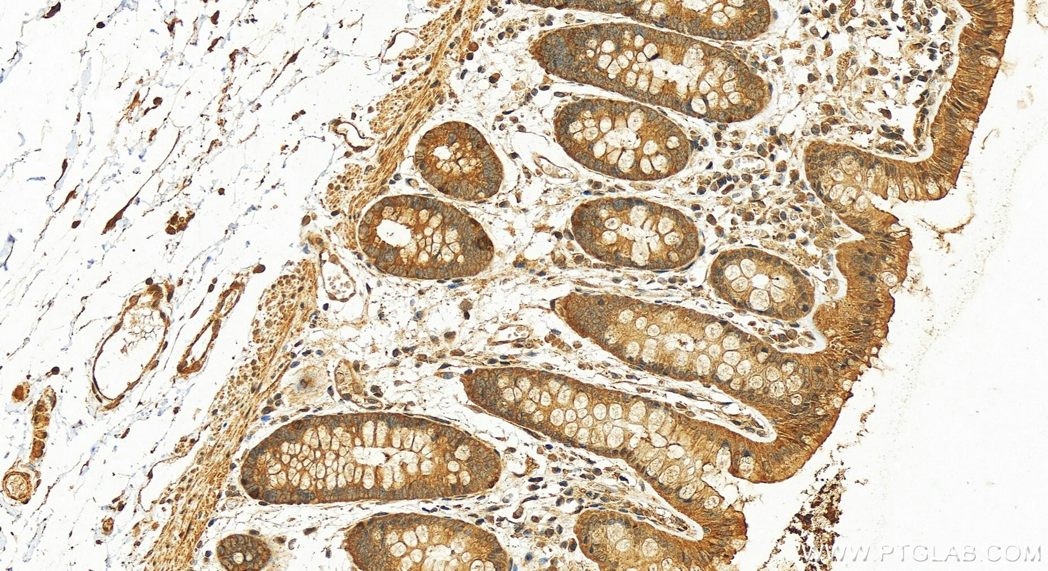 IHC staining of human colon using 24024-1-AP