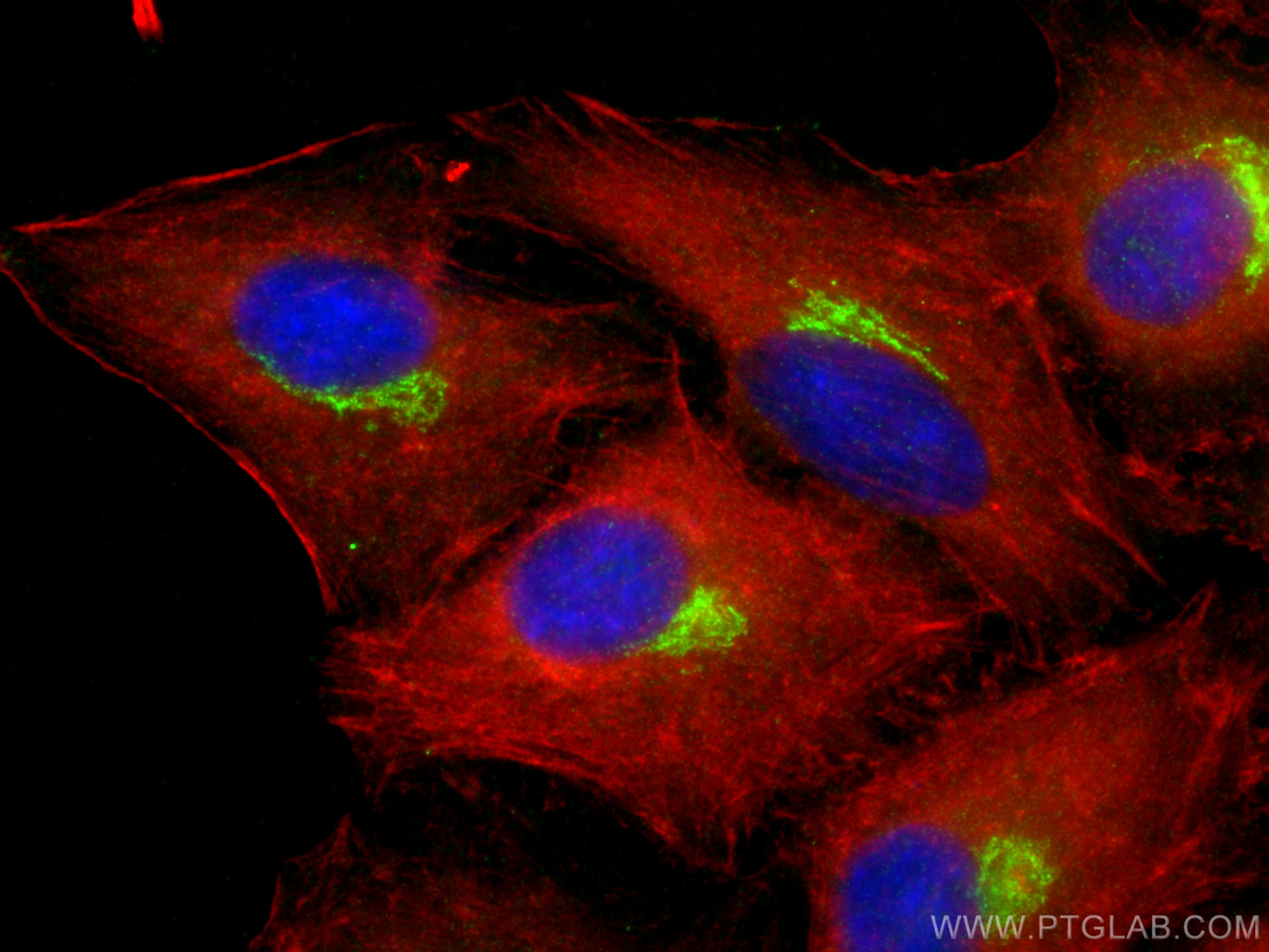 IF Staining of A549 using 15200-1-AP