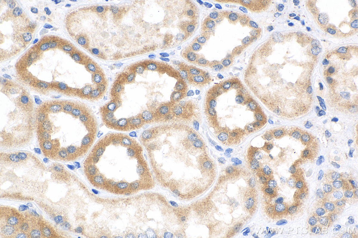 IHC staining of human kidney using 15200-1-AP