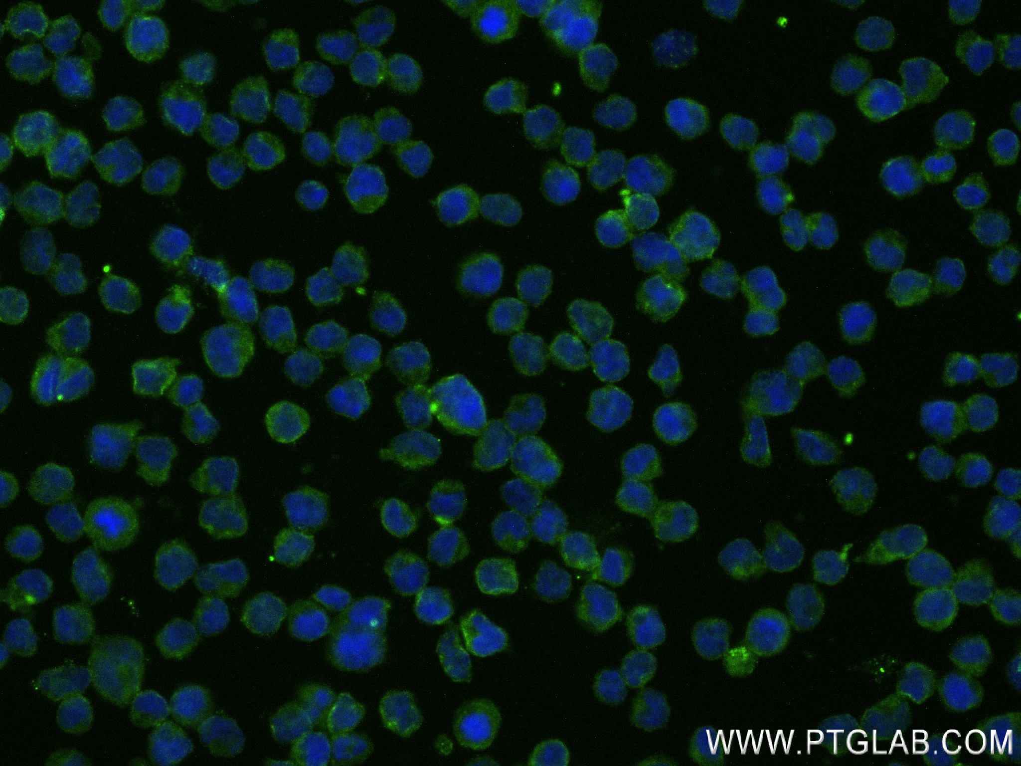 IF Staining of Raji using 83908-4-RR