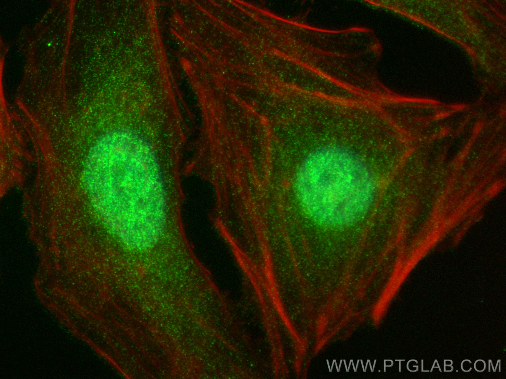 IF Staining of HeLa using 82842-7-RR (same clone as 82842-7-PBS)