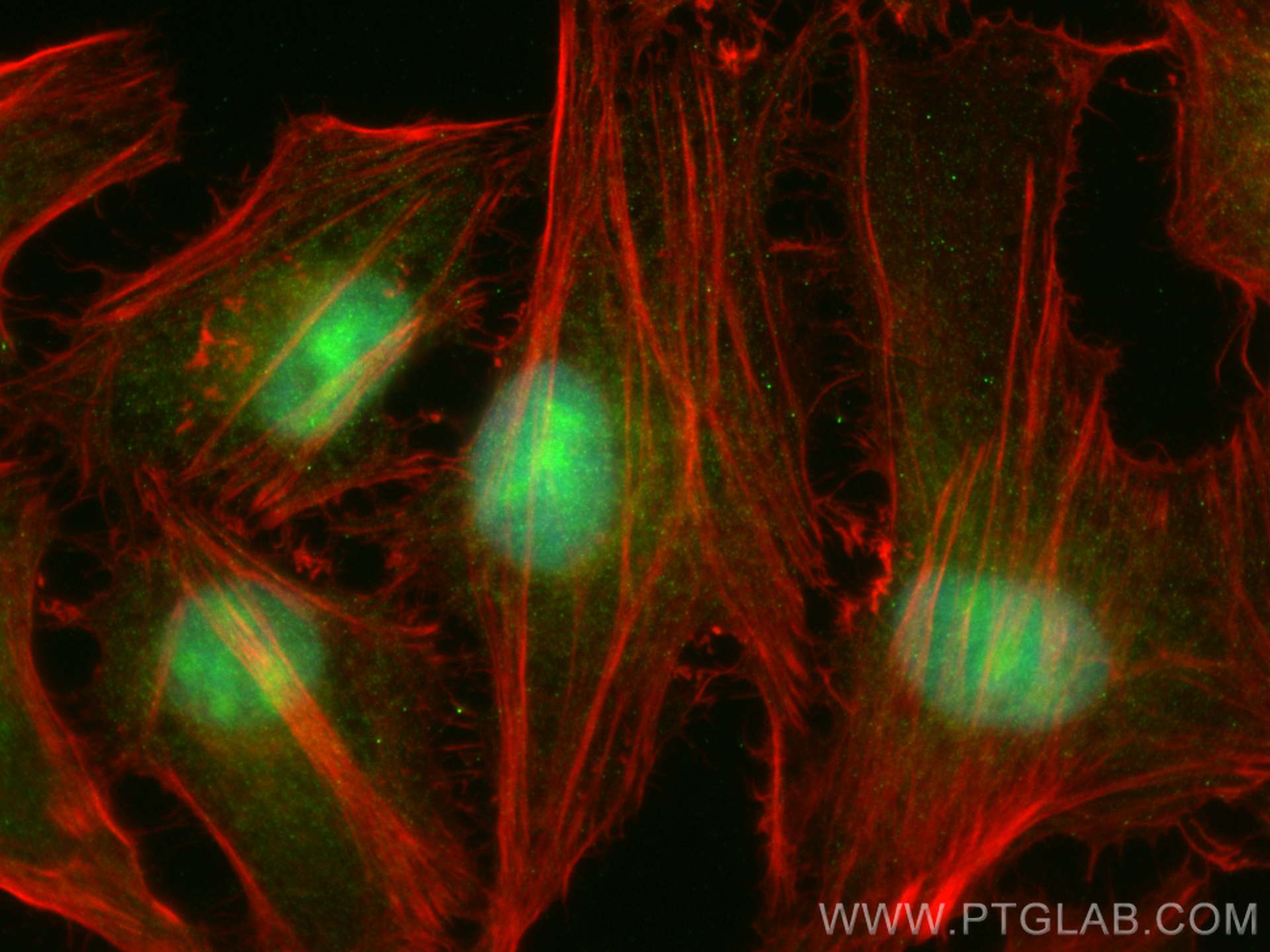 IF Staining of HeLa using 19064-1-AP