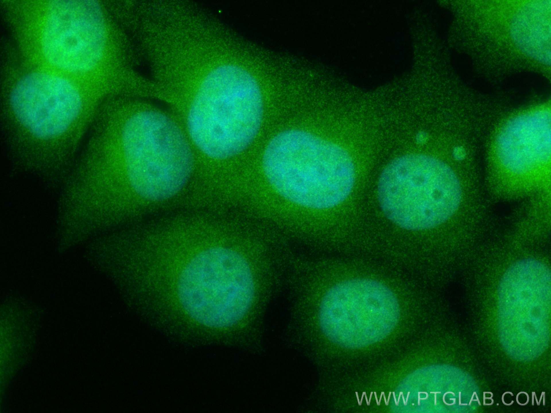 IF Staining of MCF-7 using 26628-1-AP