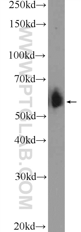 WB analysis of HeLa using 25692-1-AP