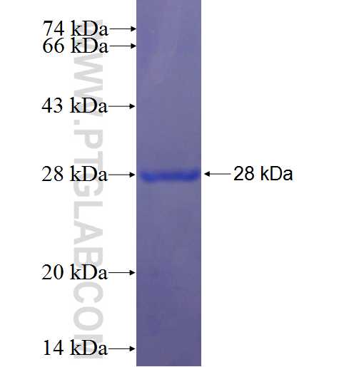 BAIAP2L1 fusion protein Ag22531 SDS-PAGE