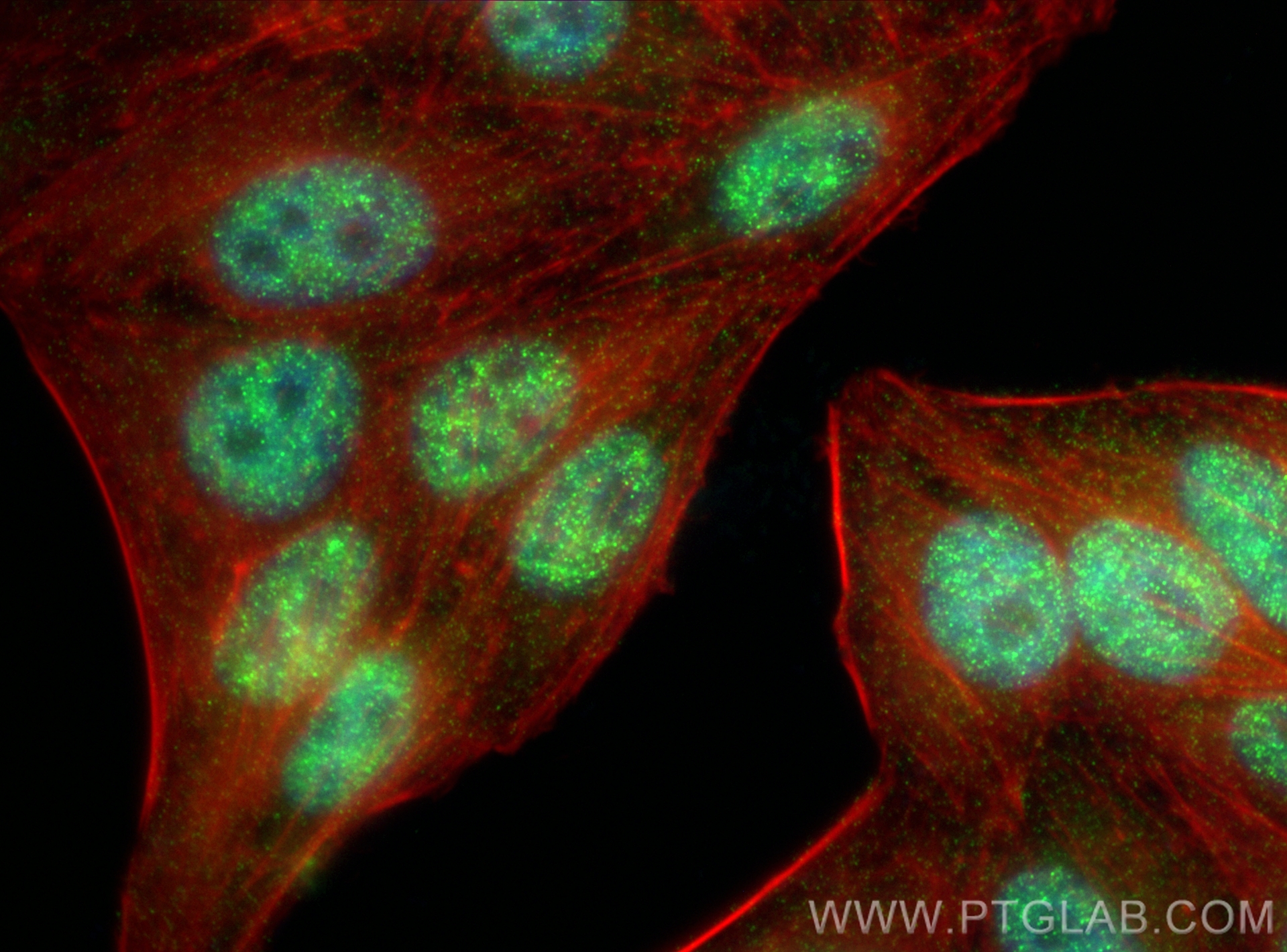 IF Staining of HepG2 using 83596-4-RR (same clone as 83596-4-PBS)