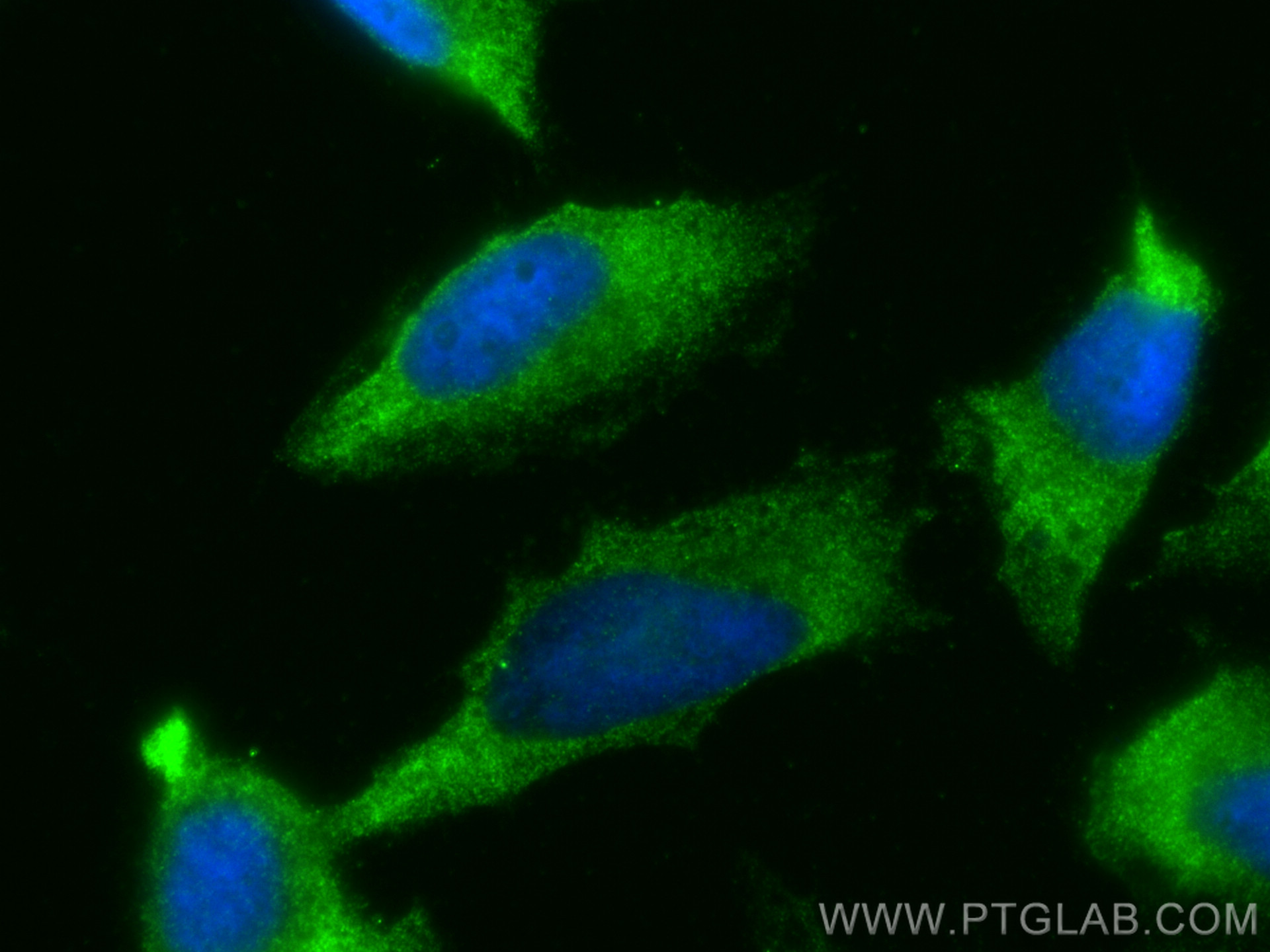 IF Staining of HeLa using 21455-1-AP