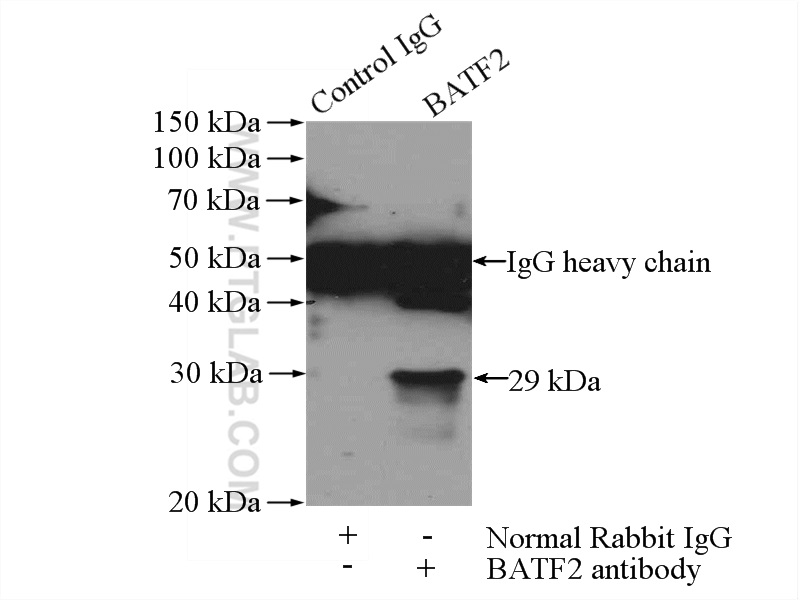 IP experiment of HeLa using 16592-1-AP