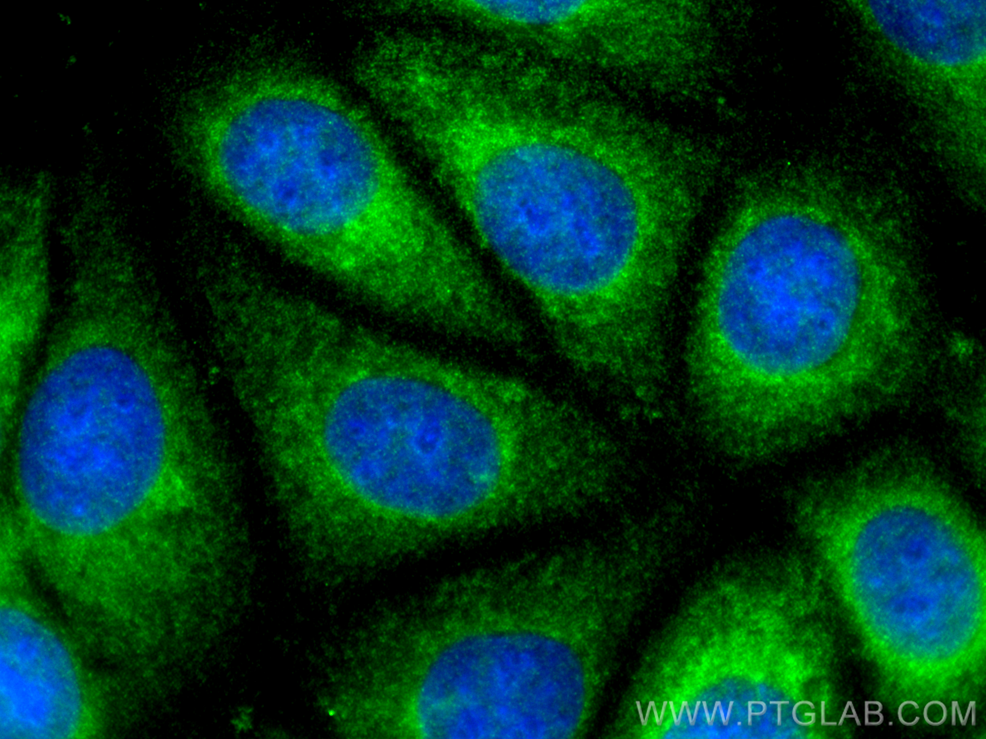 IF Staining of MCF-7 using 50599-2-Ig