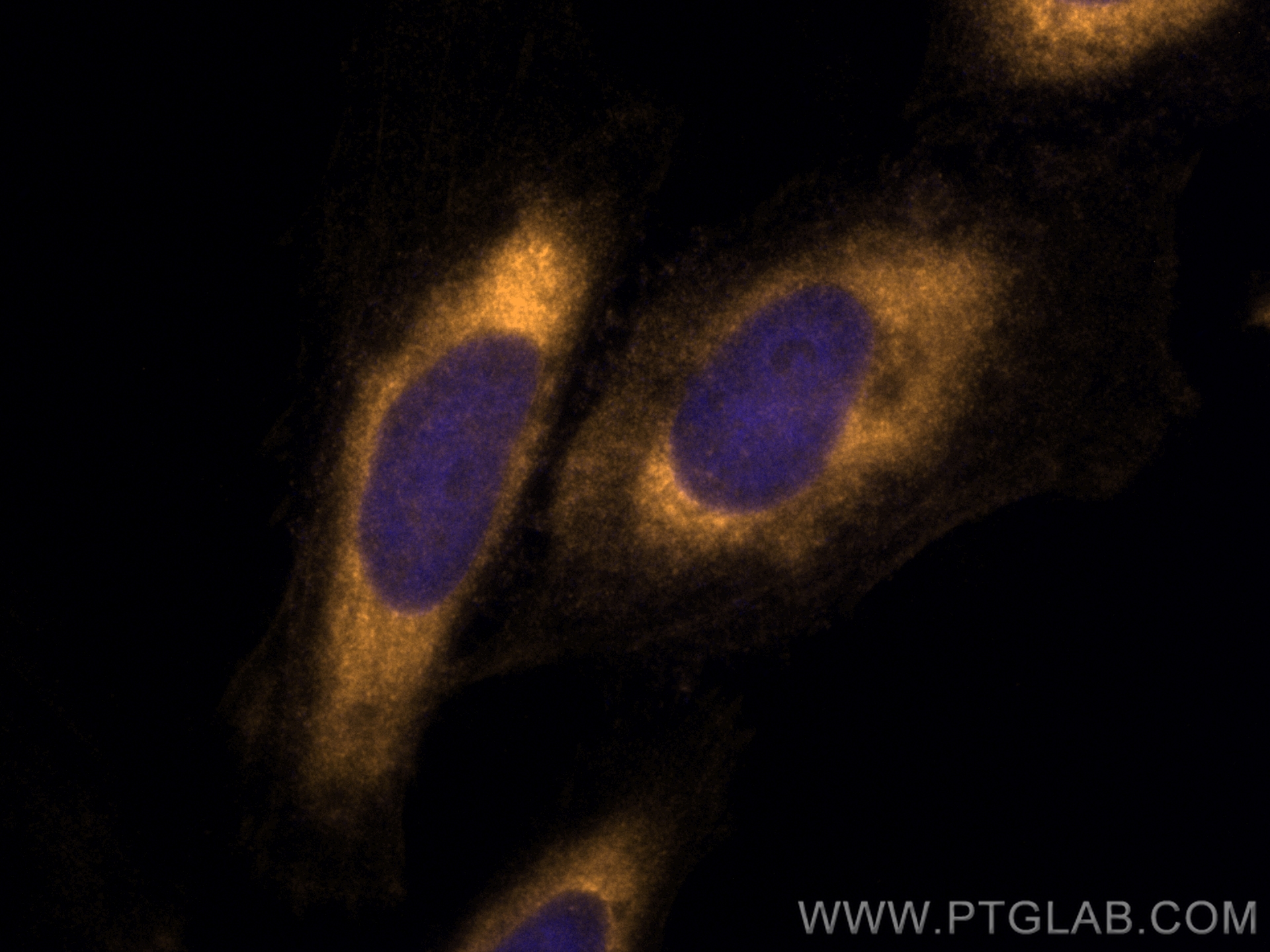 IF Staining of HeLa using CL555-60267