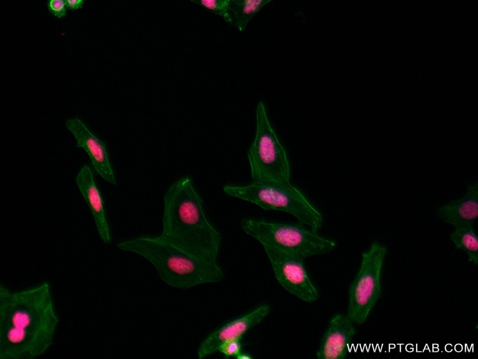 IF Staining of HepG2 using 82910-1-RR