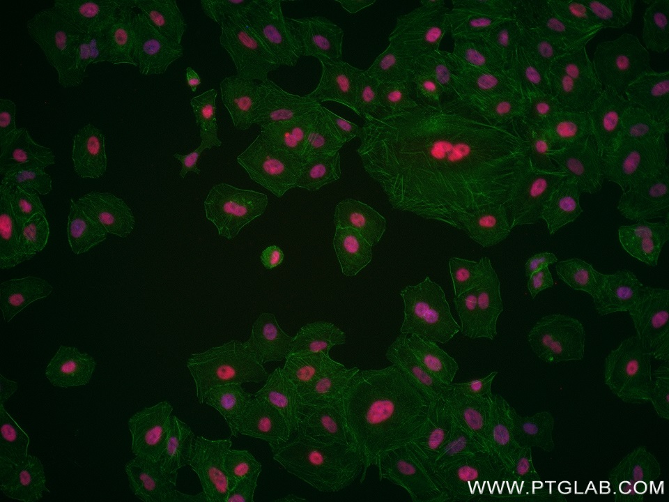 IF Staining of A549 using 82910-1-RR (same clone as 82910-1-PBS)