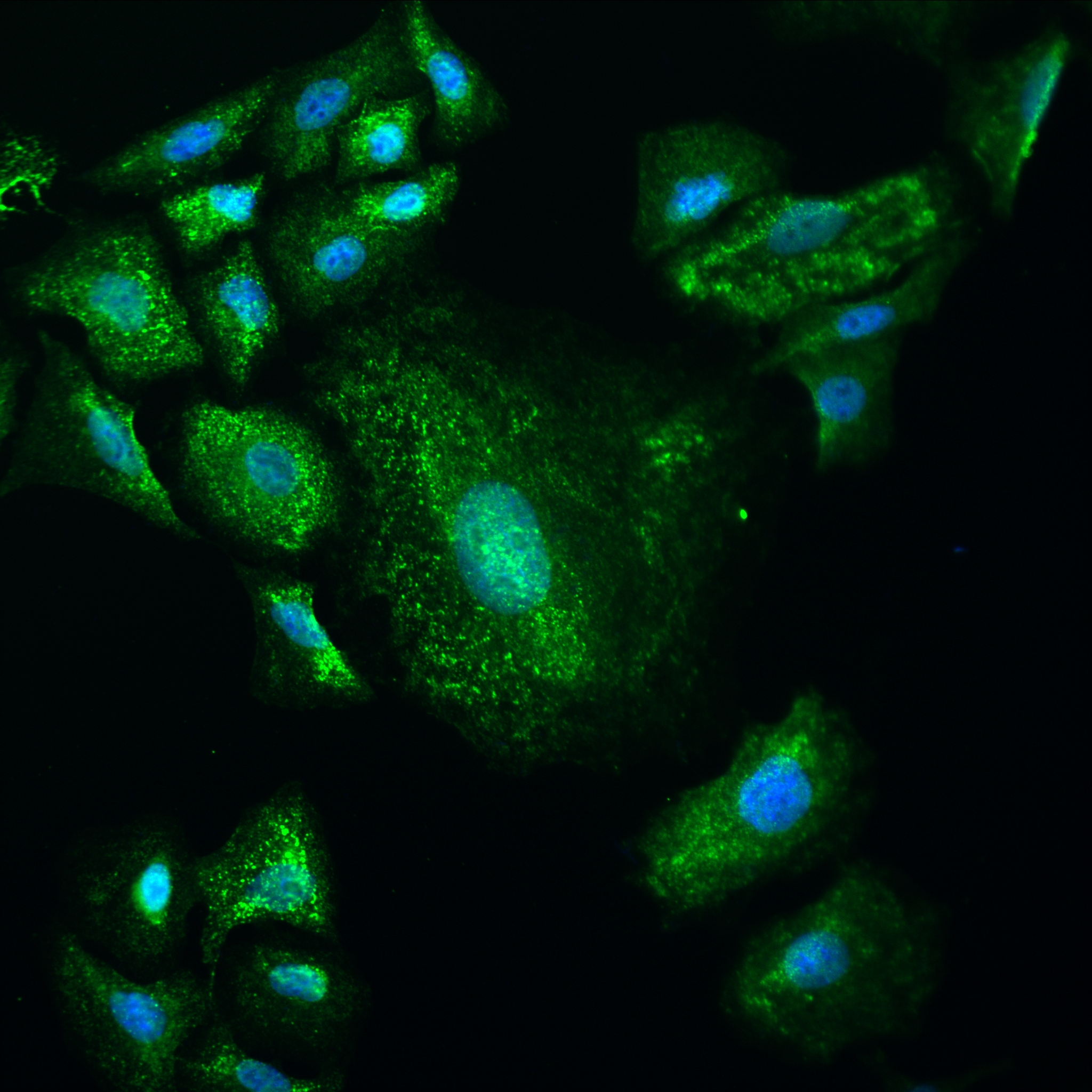 IF Staining of A549 using 82910-2-RR