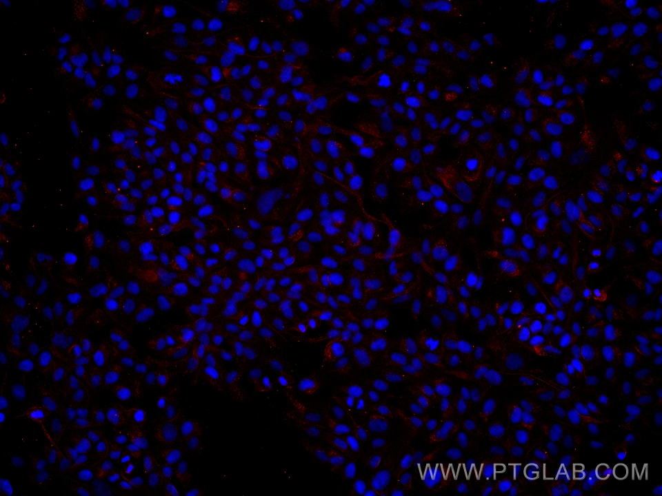 IF Staining of hTERT-RPE1 using 66136-1-Ig