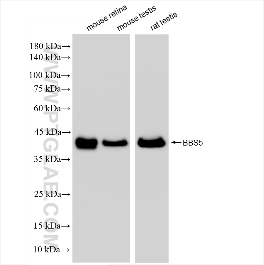 WB analysis using 83722-1-RR (same clone as 83722-1-PBS)