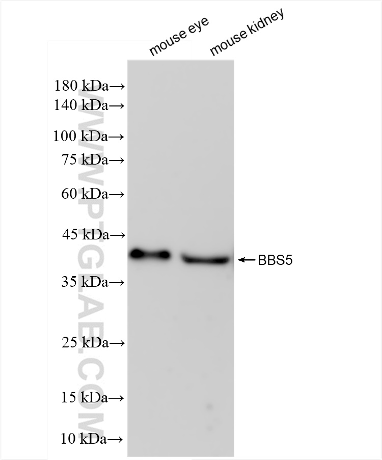 WB analysis using 83722-1-RR