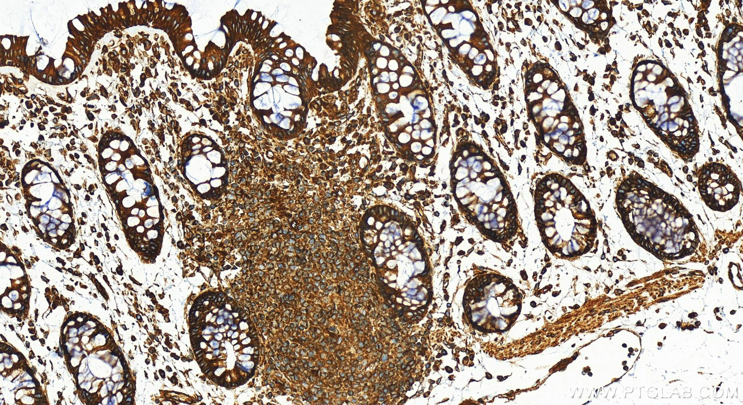 IHC staining of human colon using 11200-1-AP