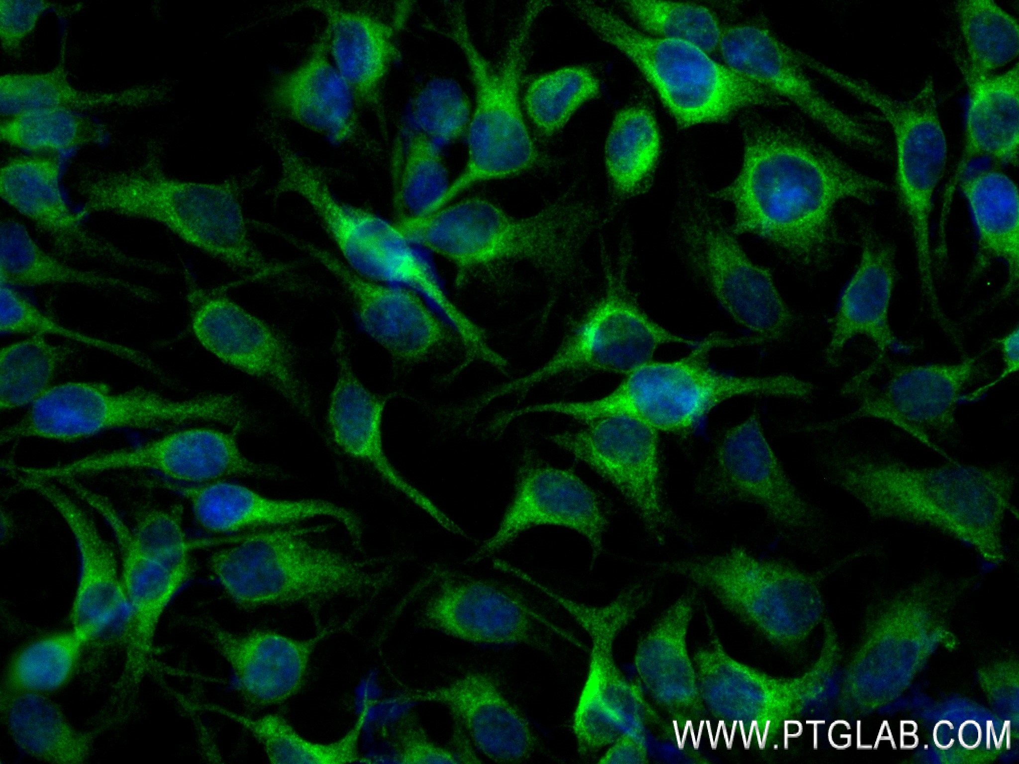 IF Staining of HeLa using 84584-5-RR