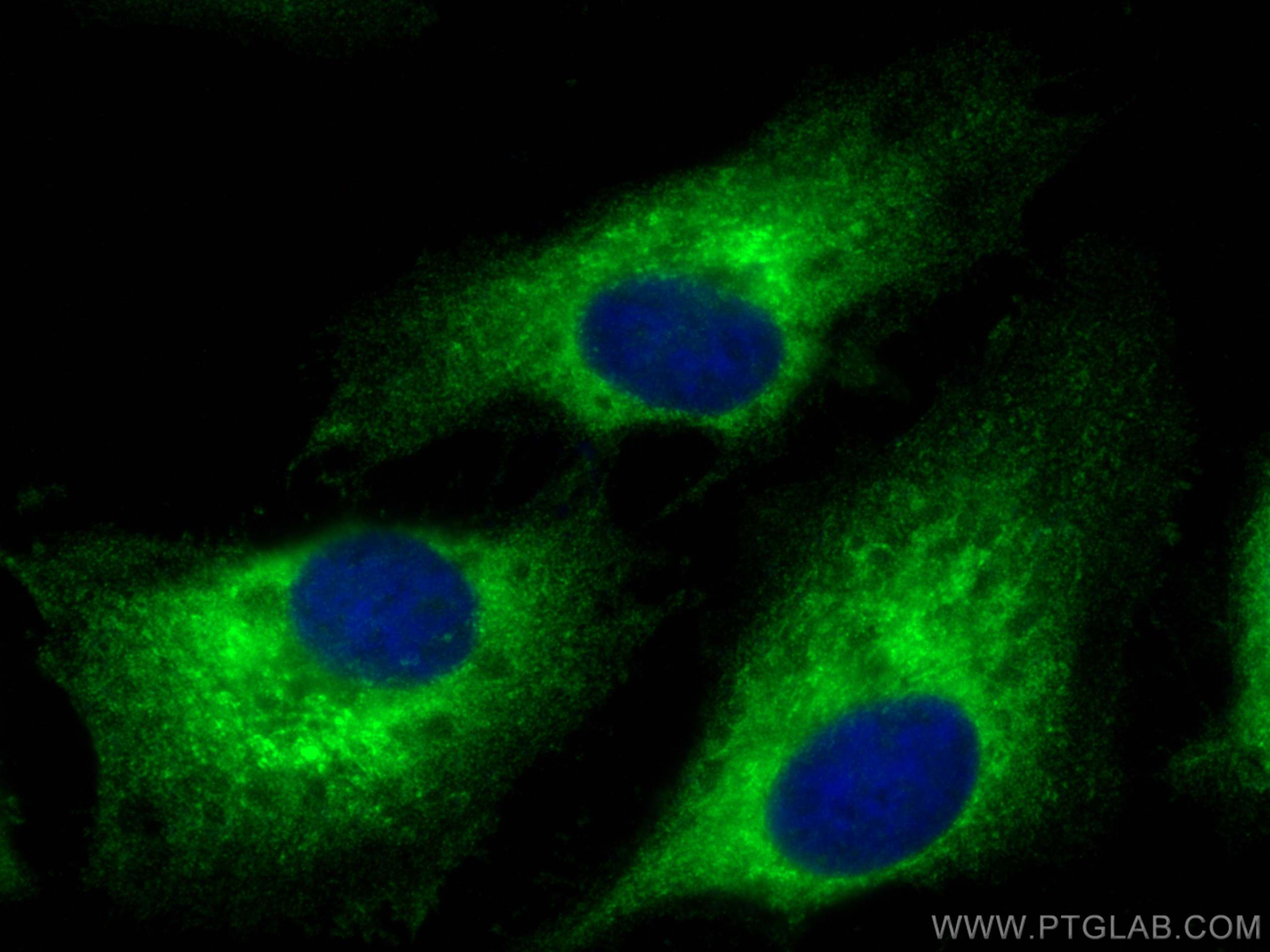 IF Staining of HeLa using 16815-1-AP