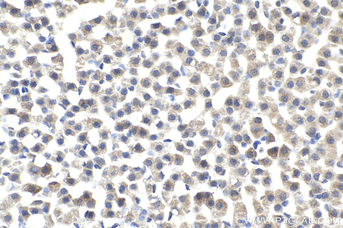 IHC staining of rat adrenal gland using 13628-1-AP