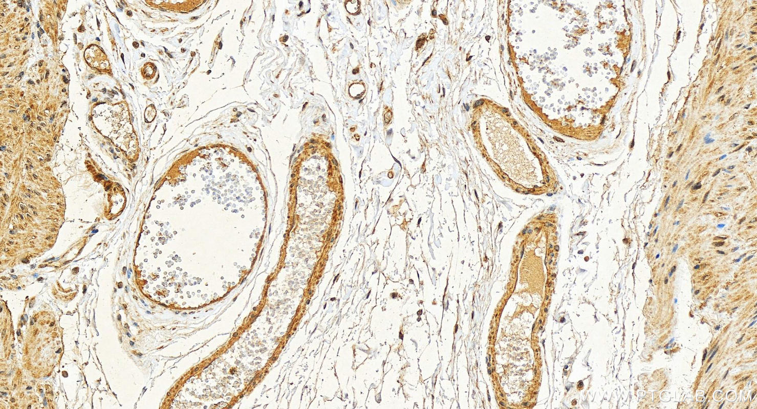 IHC staining of human stomach using 25776-1-AP