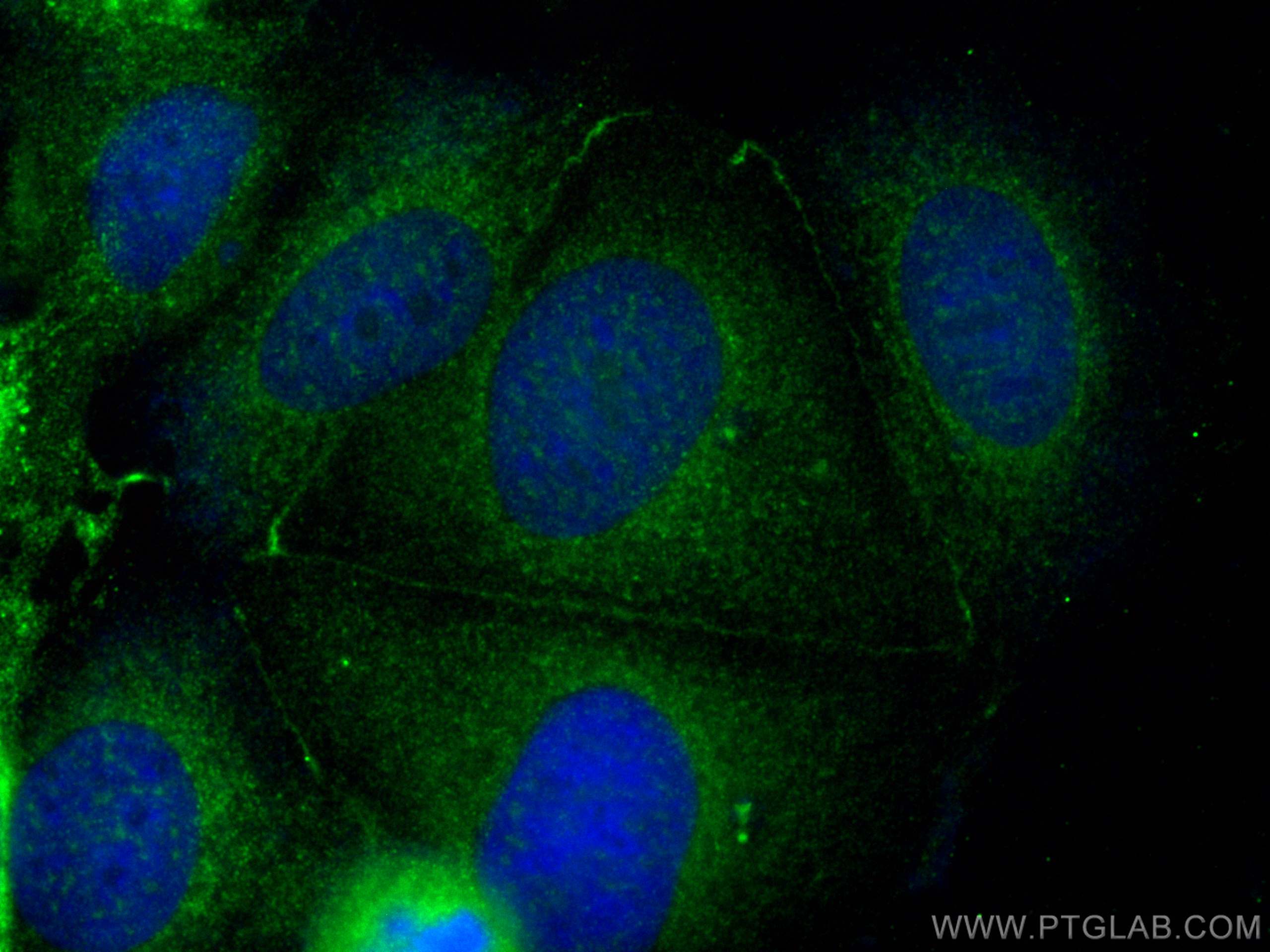 IF Staining of MCF-7 using 25776-1-AP