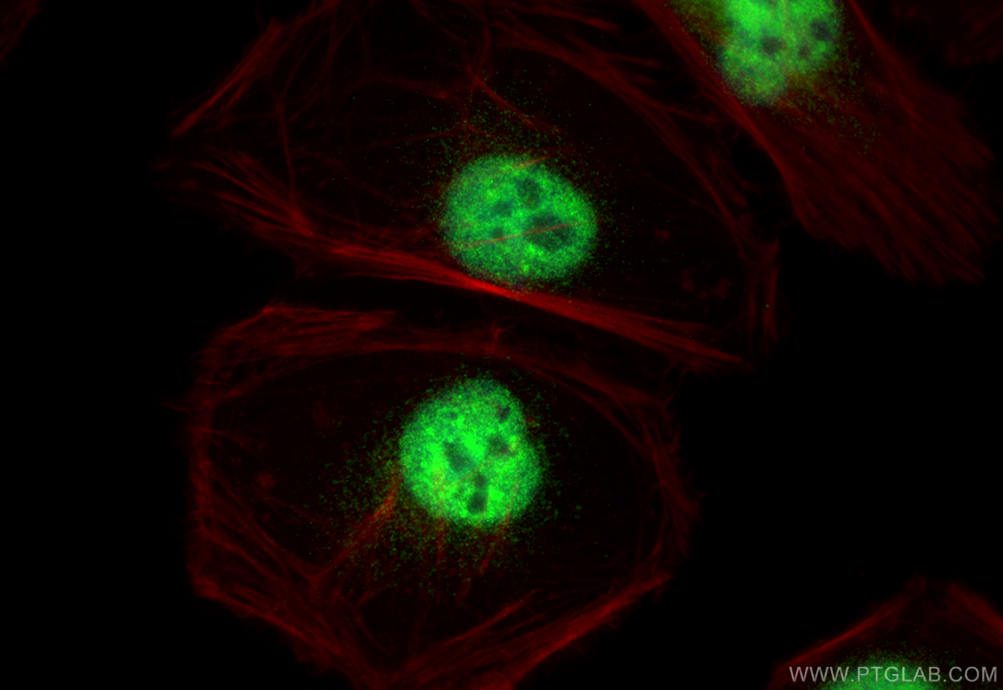 IF Staining of HeLa using 10414-1-AP