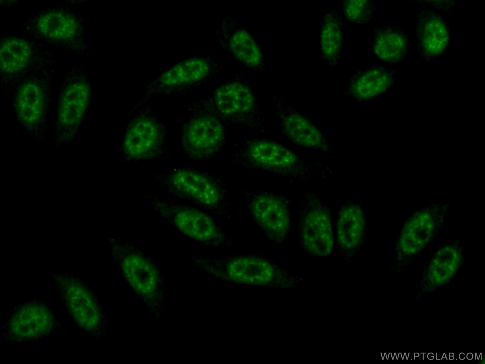 IF Staining of HepG2 using 10414-1-AP