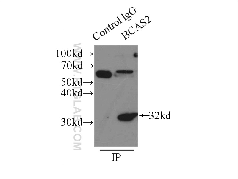 IP experiment of mouse brain using 10414-1-AP